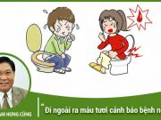 Đi ngoài ra máu tươi "báo động đỏ" của 5 bệnh nguy hiểm