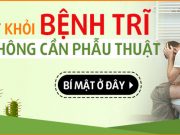 điều trị bệnh trĩ không cần phẫu thuật