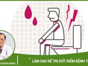 Làm sao để trị dứt điểm bệnh trĩ?