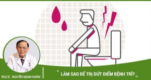 Làm sao để trị dứt điểm bệnh trĩ?