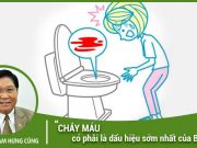 Chảy máu có phải dấu hiệu sớm nhất của bệnh trĩ?