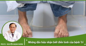 Những dấu hiệu nhận biết điển hình của bệnh Trĩ