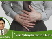 Viêm đại tràng lâu năm có bị bệnh trĩ?