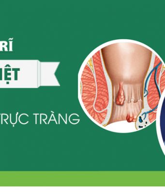 Phân biệt bệnh trĩ và ung thư trực tràng