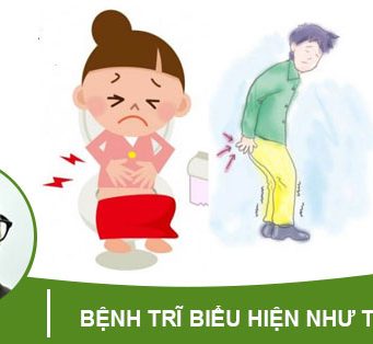 Bệnh trĩ có biểu hiện như thế nào ?