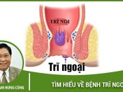 bệnh trĩ ngoại là gì