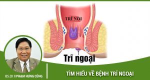 bệnh trĩ ngoại là gì