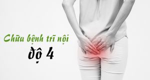 cách chữa bệnh trĩ nội độ 4 hiệu quả và an toàn