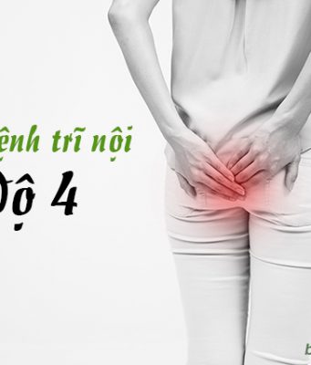 cách chữa bệnh trĩ nội độ 4 hiệu quả và an toàn