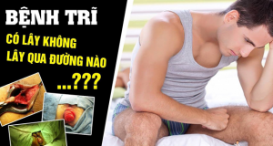 bệnh trĩ nội có lây không?